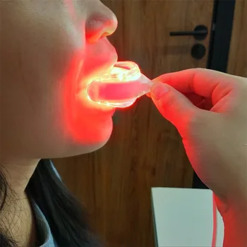Zobs, Čūlas Ārstēšana Atslodzes Gingivīts Terapijas LED Sarkanās Gaismas Therapentic Ierīces